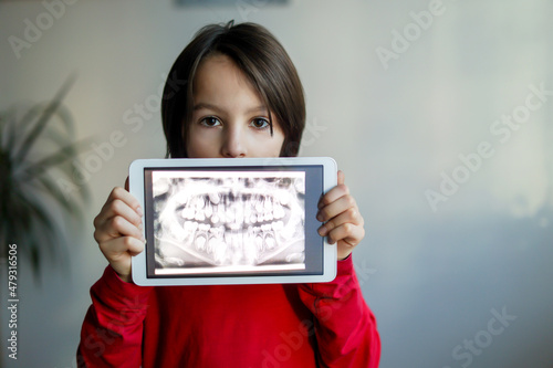 Child, wearing braces, preteen boy, holding tablet with a picture of his x-ray teeth from the dentistof him photo