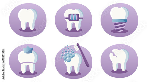 Dental set of diffrent teeth. Dental implant, tooth with braces, dental crown, broken tooth, teeth cleaning.