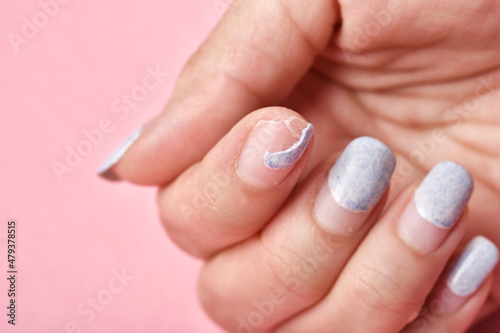 Cracked broken nail, Nail weakness damage from gel polish coating, Fingernail manicure hygiene.