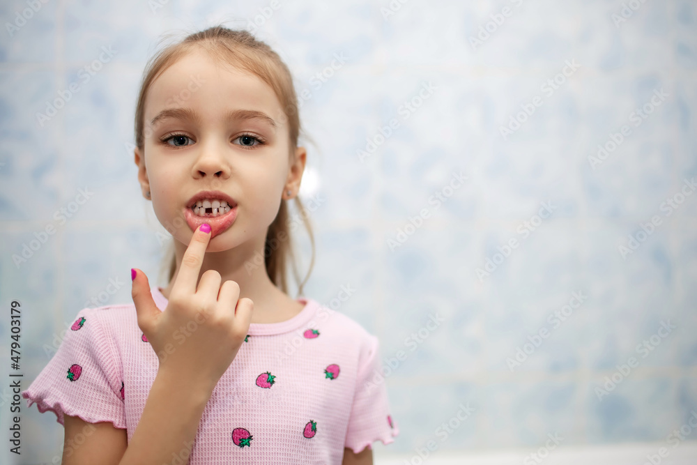 The girl shows her mouth without one milk tooth that has fallen out ...