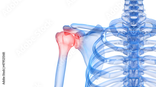 Tableau sur toile 3d rendered illustration of a painful shoulder