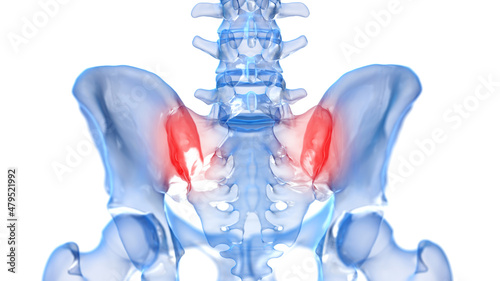 3d rendered illustration of a painful sacroiliac joint photo