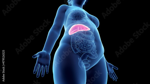 3d rendered illustration of an obese womans liver photo