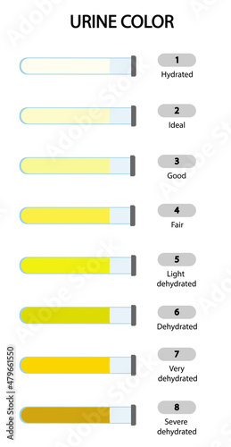 Urine Color scale chart. Scale to analyse the hydration of a patient based on the urine color.