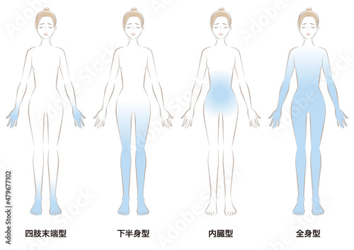 冷え性の4つのタイプ