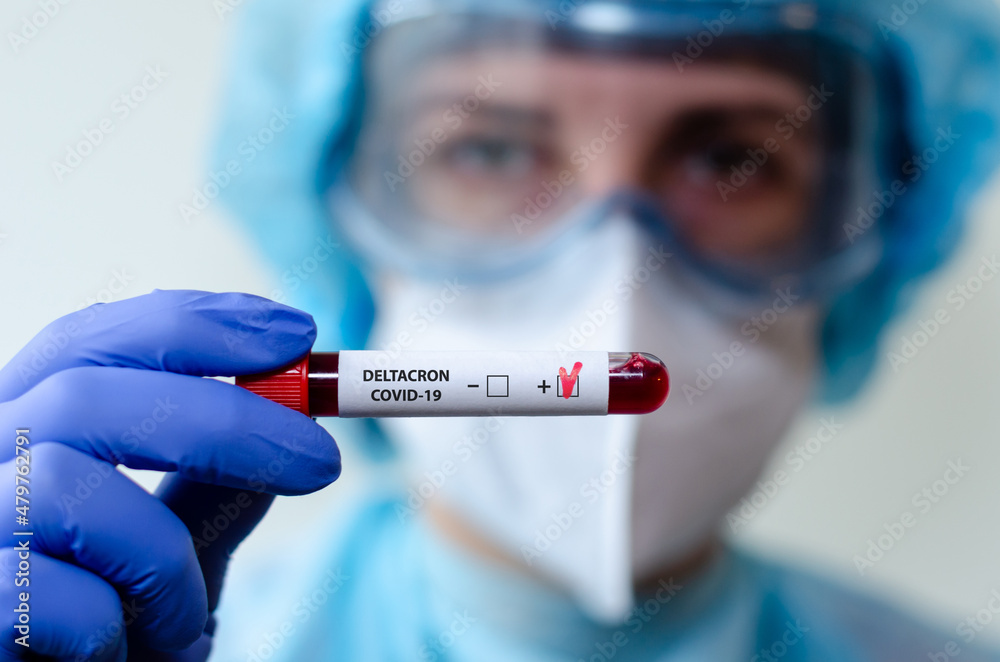 Medical laboratory assistant holding test tube with positive Deltacron COVID-19 test blood sample. Medical laboratory assistant holding test tube with positive Deltacron COVID-19 test blood sample.