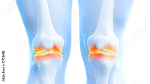 3d rendered illustration of painful knee joints