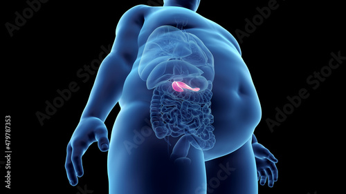 3d rendered illustration of an obese mans pancreas