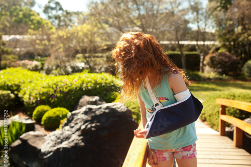 Girl with a broken arm looking over a bridge photo