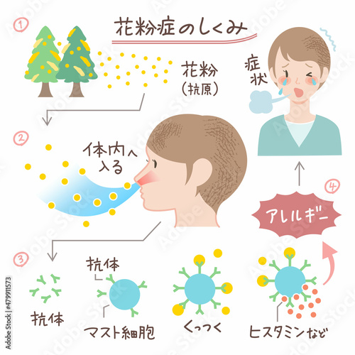 花粉症のしくみのイラスト 説明図 図表 アレルギー
