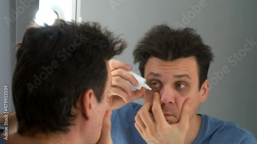 Man is dripping drops in his eyes in front of the mirror at home. He is looking at his reflection in the mirror. Eye fatigue, manager syndrome, exhaustion, stress, overwork, sleep disorder concepts. photo