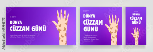Fototapete Dünya Cüzzam Günü Translation: world leprosy day 25 january