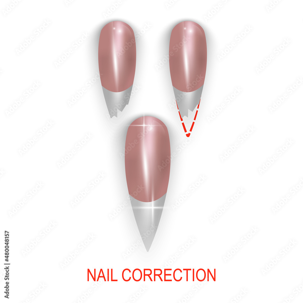 Restoration of a broken nail, nail salon, vector illustration Restoration of a broken nail, nail salon, vector illustration