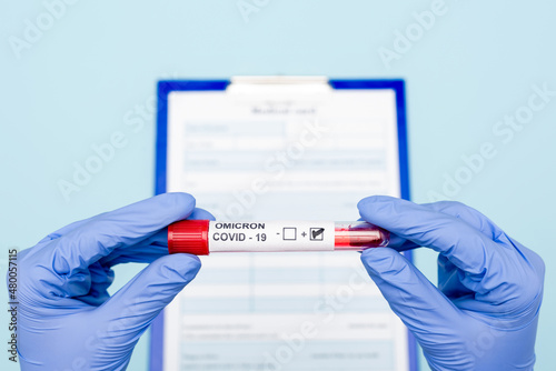 cropped view of doctor in latex gloves holding test tube with covid-19 positive result near blurred clipboard on blue.