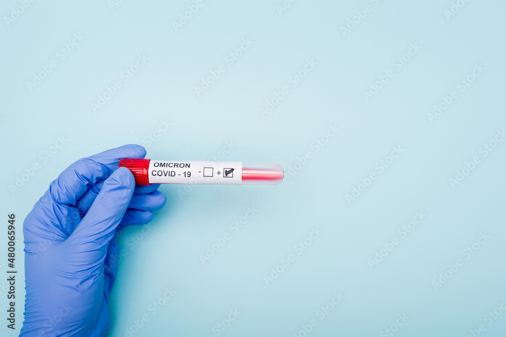 Obraz premium partial view of doctor holding positive covid-19 omicron variant test on blue background.