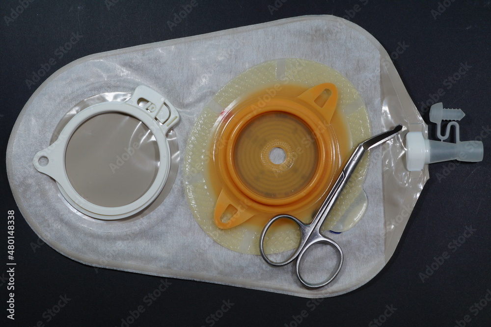 Urostomy And Nephrostomy Bag - Ostomy Medical Care Equipmen: Two-piece ...