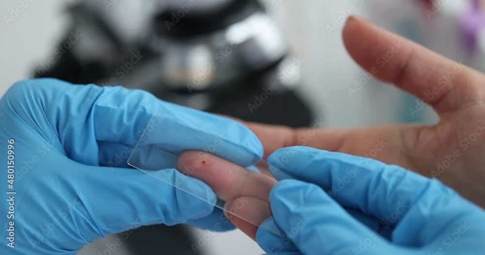 Laboratory technician drips human red blood onto glass for virus test Laboratory technician drips human red blood onto glass for virus test