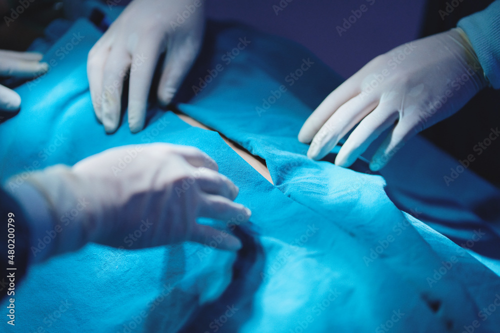 Operating team prepare to surgical patient in surgery room Operating team prepare to surgical patient in surgery room