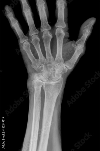 Wrist Radiography of a patient suffering from pain