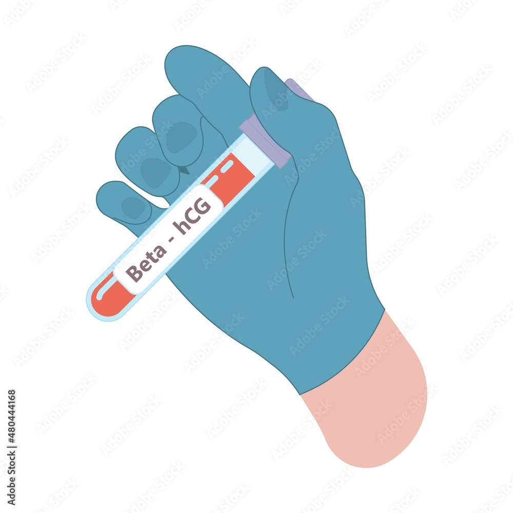 Beta HCG Levels Blood Test At Home Period Of Days False Result Weeks