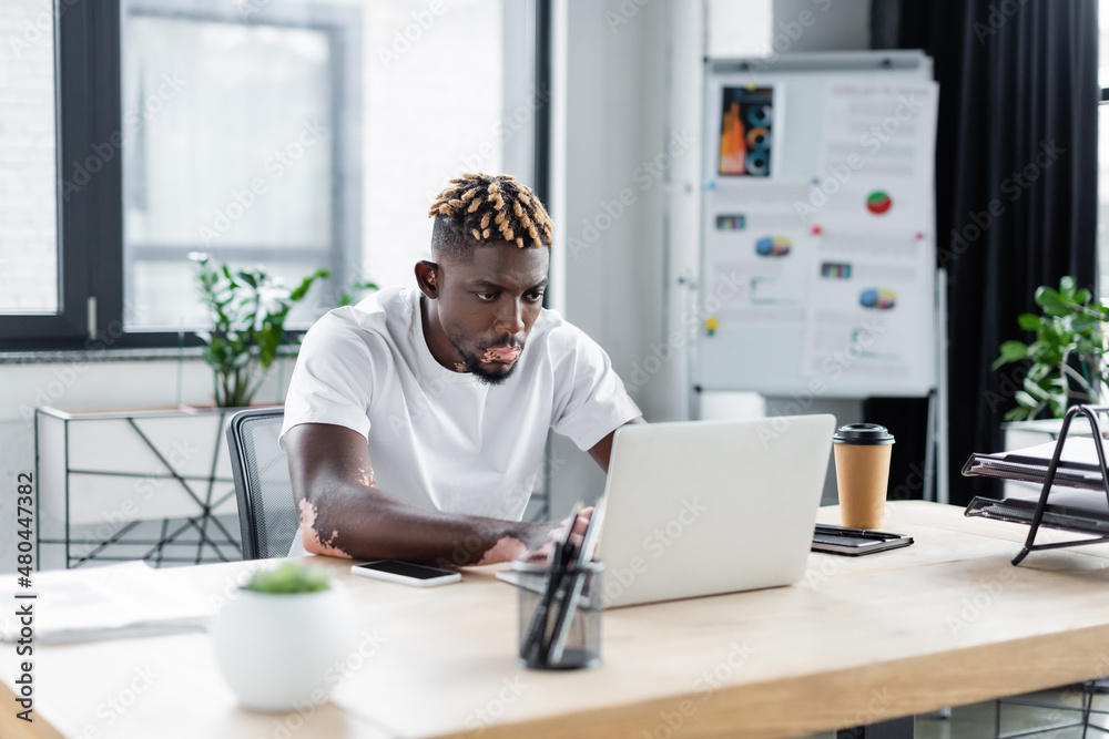 young african american man with vitiligo working on laptop near paper cup in office. young african american man with vitiligo working on laptop near paper cup in office.