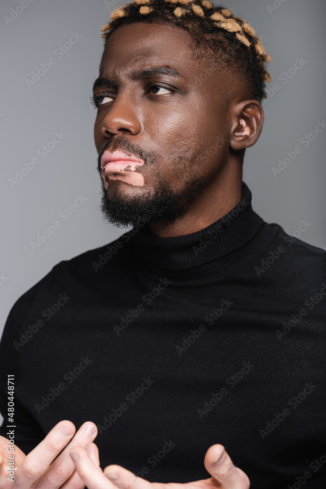 Fototapeta premium serious african american man with vitiligo gesturing and looking away while thinking isolated on grey.