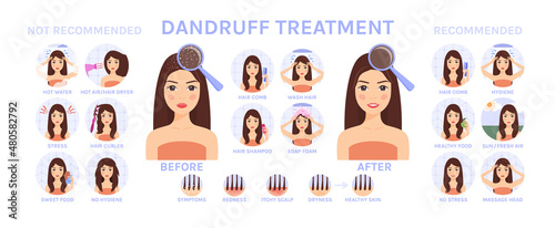 Woman with Dandruff on Head. Dandruff Treatment. Recommendations. Steps. Before and After. Symptoms. Happy Girl with Healthy skin. Set. Cartoon style. Vector illustration for Medical and Beauty Design