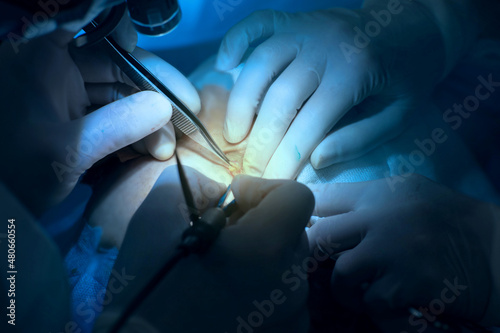 surgical operation  in the surgeon s hand close-up tweezers.