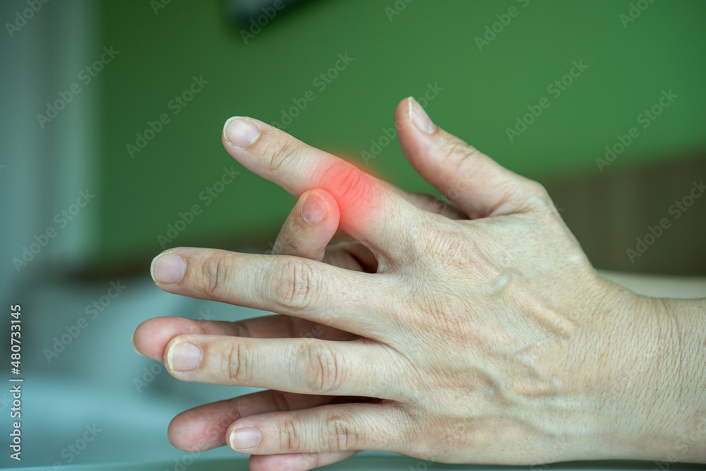 Fotografia do Stock Trigger Finger Overuse hand problems. Woman’s hand with red spot o fingers