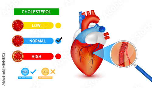 Medical blood test using a magnifying glass cholesterol meter scale comparison with HDL and LDL lipoprotein. Normal blood flow and Cholesterol in human heart. Hematologic diseases concept. Vector.