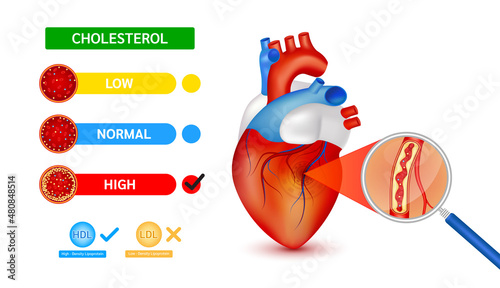 Medical blood test using a magnifying glass cholesterol meter scale comparison with HDL and LDL lipoprotein. Normal blood flow and Cholesterol in human heart. Hematologic diseases concept. Vector.