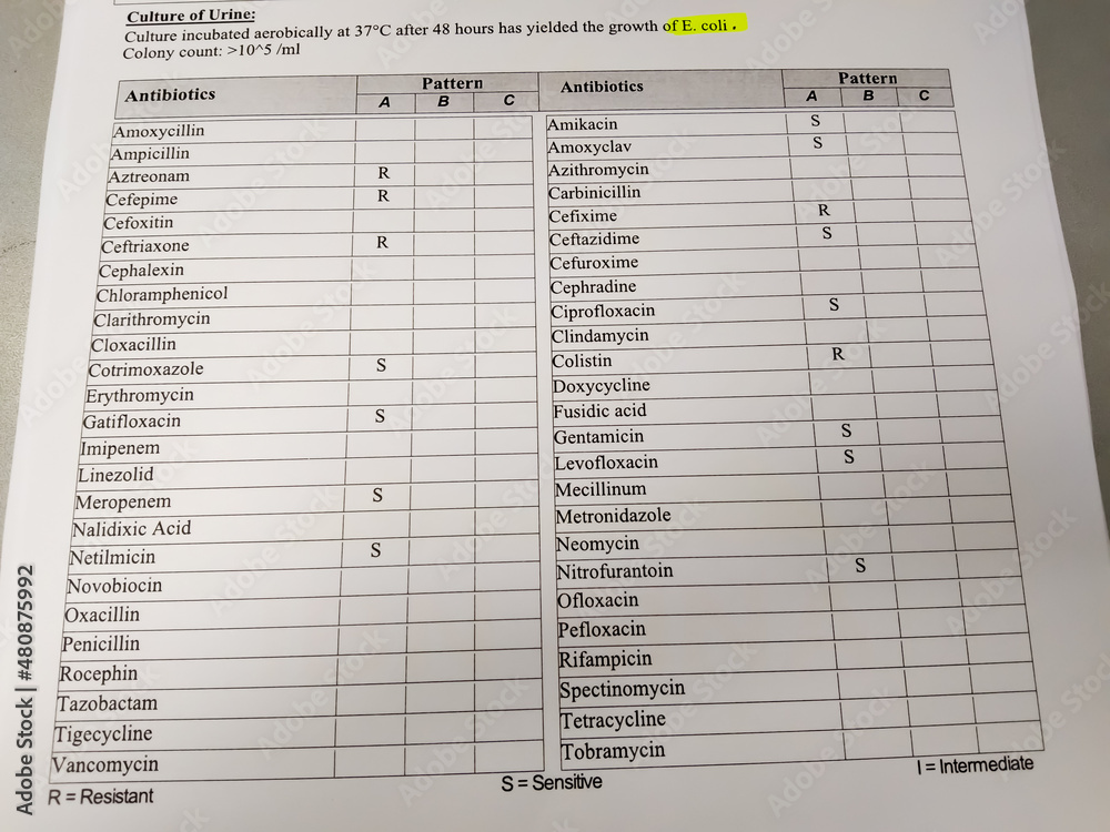 Urine Culture and sensitivity test, growth of Escherichia coli (E.coli