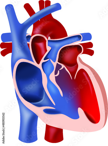 Heart with tetralogy of Fallot