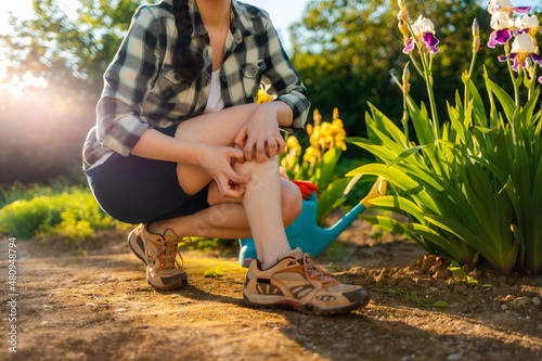 Summer season. Woman scratches her leg, which is itchy from a mosquito bite. Close up of legs. Outdoor. Allergies and insect bites concept photo