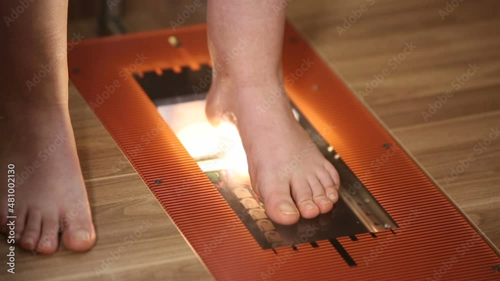 Special orthopedic equipment for feet examination. Female patient