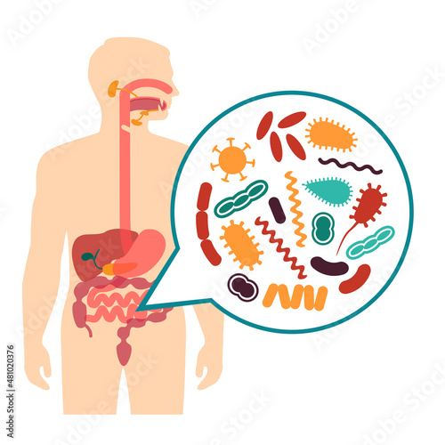 medical vector illustration of stomach ache, human digestive system problems