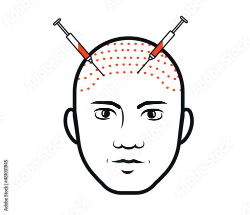 Hair loss treatment. Hair loss. Bald place on scalp. Vector illustration.