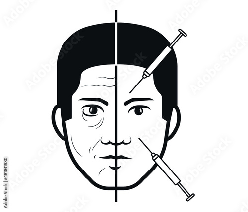 before and after facial wrinkles treatment. Plastic surgery and botox. male facial treatment concept.
