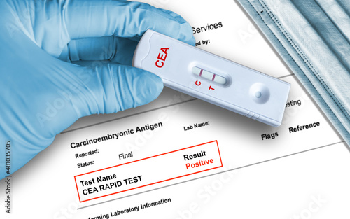 Positive CEA rapid test result by using rapid testing cassette to detect intestinal cancer photo