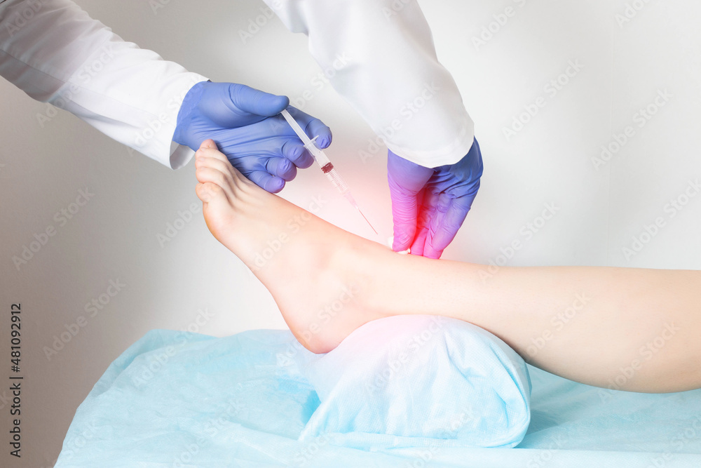 Doctor orthopedist makes an injection with blockade medication for cartilage regeneration and metabolism, close-up Doctor orthopedist makes an injection with blockade medication for cartilage regeneration and metabolism, close-up