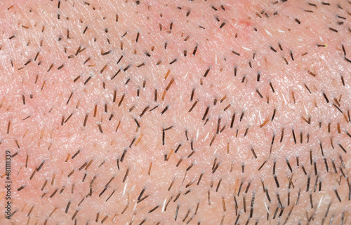 Human face and body hair, bristles close-up.
