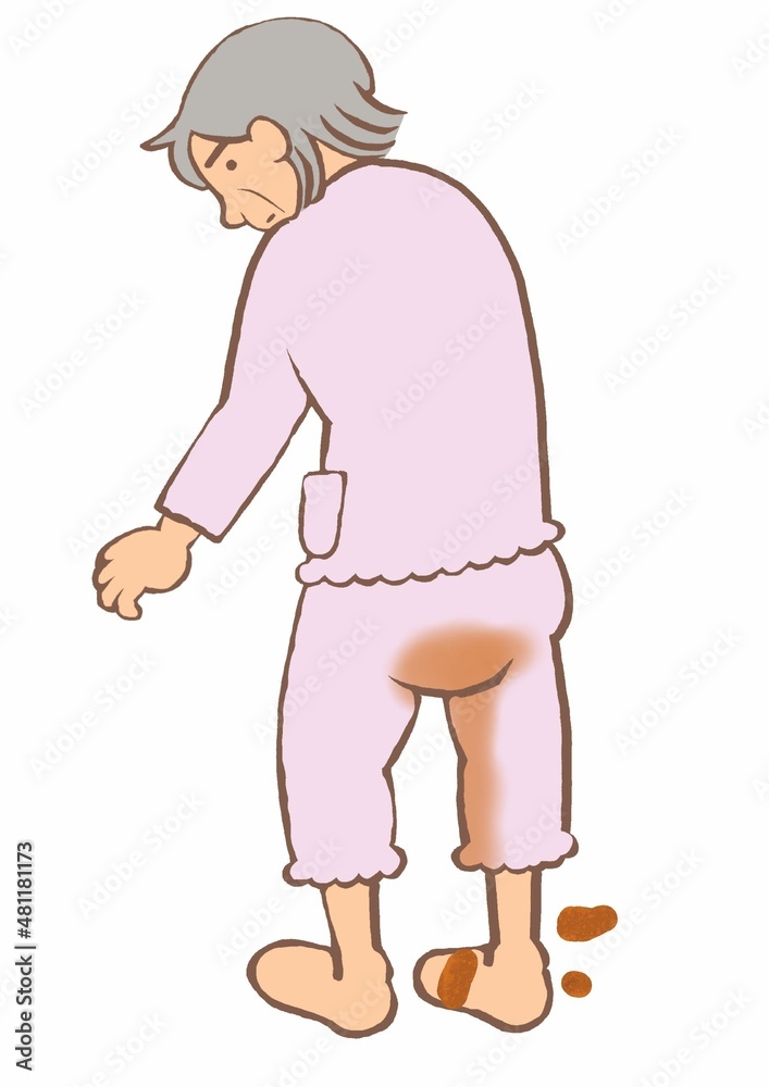 認知症　便失禁する高齢女性
