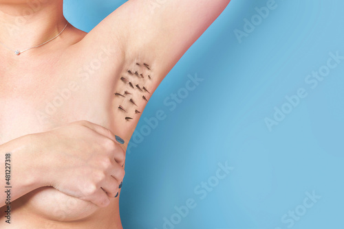 The concept of depilation. А girl with thorns on her armpits against a blue background. photo