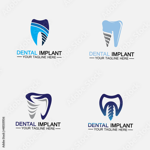 Dental implant logo vector  designs concept ,  Set Dental Clinic &Care logo template