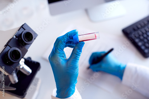 Close Up Of Lab Worker Conducting Research Using Microscope Holding Blood Sample With Blank Label
