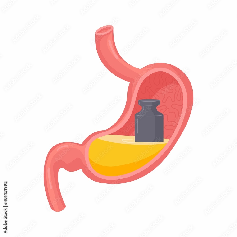 Heaviness in stomach. Isolated vector illustration. Gases problem, gastritis design element. Unhealthy diet problem, anxiety symptom.