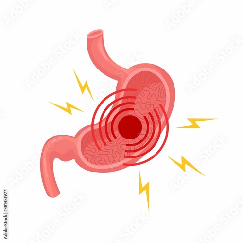 Pain and sick in stomach Gastritis, indigestion and ulcer problems. Vector flat illustration on white background photo