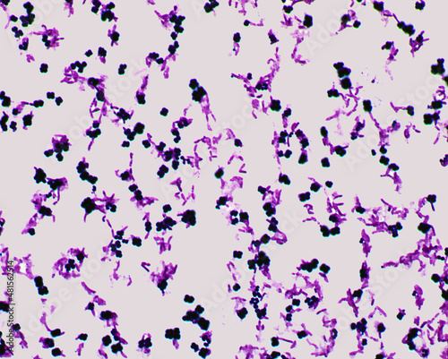 Gram staining of a mix of Micrococcus luteus and Pseudomonas entomophila bacteria photo