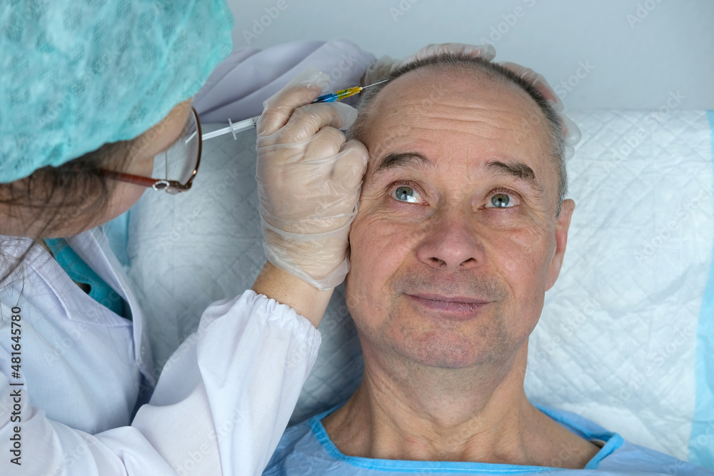 close-up trichologist treats patient, bald mature man with alopecia in hair growth clinic, anti-aging treatments for balding men. concept of hair transplant procedures for men, selective focus close-up trichologist treats patient, bald mature man with alopecia in hair growth clinic, anti-aging treatments for balding men. concept of hair transplant procedures for men, selective focus