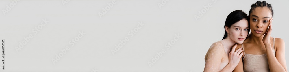 African young woman standing with caucasian woman African young woman standing with caucasian woman